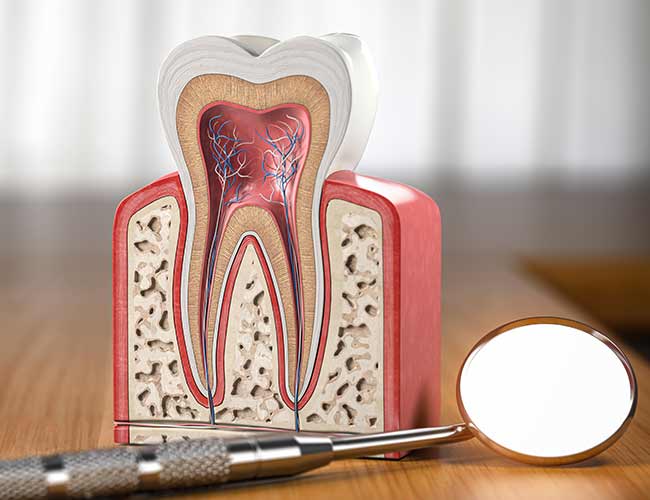 What To Expect From a Root Canal